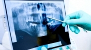 RADIOLOGÍA ORAL Y MAXILOFACIAL