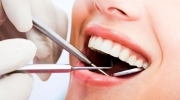 LIMPIEZA E HIGIENE DENTAL